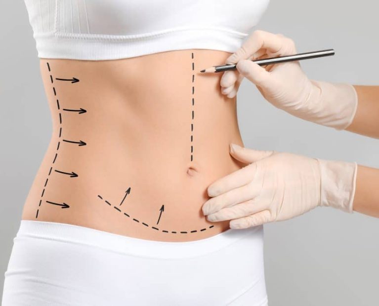 Blog_-Lower-and-Upper-Body-Lifts-1024x683