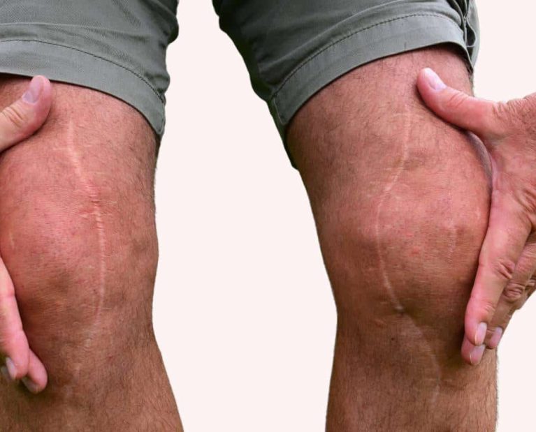 lower-extremity-pink